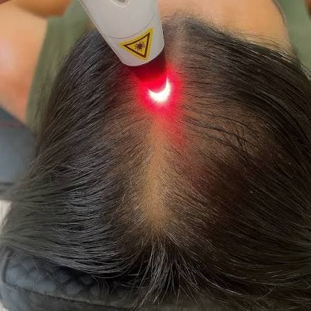 Anterior
