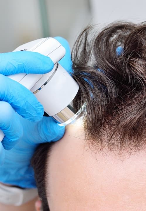Tricoscopia Digital de Alta Precisão